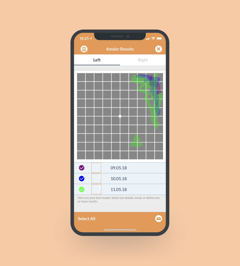 Amsler grid test in the app